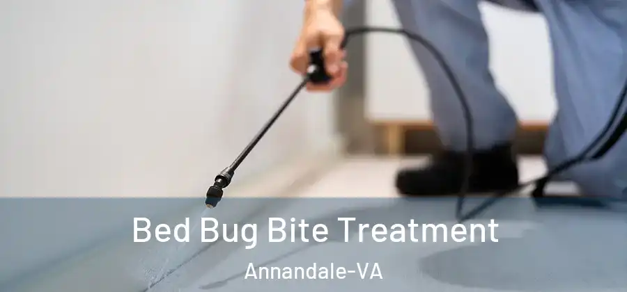 Bed Bug Bite Treatment Annandale-VA